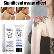 sjfscqr Tattoo Removal Cream,Care Gel Moisturizing Skin Repairing,Painless Cleaning Tattoo Removal Cream,Skin Pigment Removal Fast Absorption Gel