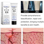 sjfscqr Tattoo Removal Cream,Care Gel Moisturizing Skin Repairing,Painless Cleaning Tattoo Removal Cream,Skin Pigment Removal Fast Absorption Gel