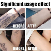 sjfscqr Tattoo Removal Cream,Care Gel Moisturizing Skin Repairing,Painless Cleaning Tattoo Removal Cream,Skin Pigment Removal Fast Absorption Gel